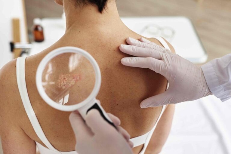 The Latest Advances in Dermatology for Treating Skin Cancer Treating Skin Cancer